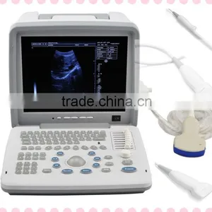 12-inch LCD Monitor Portable Ultrasound Scanner With Convex Linear Micro-convex Probe RUS 9000B thumbnail-1