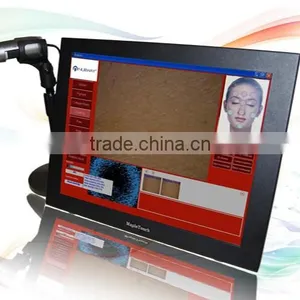 Hot New Products for 2014 Electronics 5.0mp Usb Iriscope Iridology Camera thumbnail-1