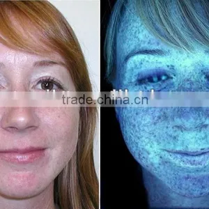 Professional Box System UV Skin Scanner Analyzer thumbnail-6