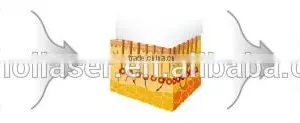 Microneedle Fractional RF Radio Frequency ROYAL- FR200 Equipment thumbnail-6