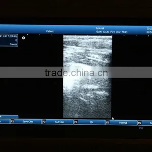 Big Sale PC Platform 10.4 Inch Laptop Ultrasound Scanner With 3.5Mhz Convex Probe CE ISO Certified thumbnail-4