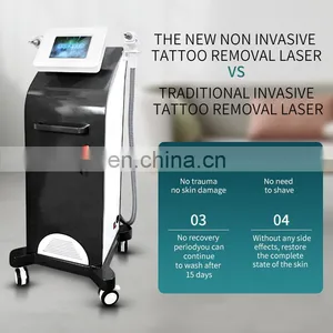 Non Invasive Tattoo Removal Laser Instrument Double Head Q Switch ND Yag Laser Machine Eyebrow Pigment Removal Beauty Instrument thumbnail-5