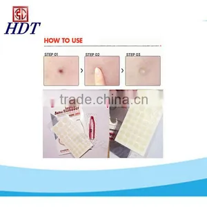 Medical Hydrocolloid Adhesive Patch for Acne thumbnail-1