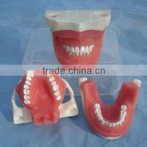 Typodent Dental Jaw Model for Practice Extract Tooth thumbnail-1