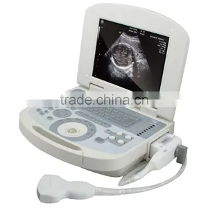 CE/ISO Professional Hospital Equipment Machine Pregnancy & Cheap Ultrasound Scanner Price thumbnail-1