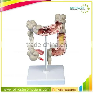Pathology Colon Model Organs Human Body Anatomy thumbnail-1