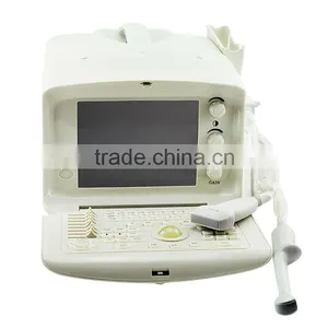 CE ISO Approved One-stop Shopping Service pc Based Ultrasound Scanner Portable Laptop thumbnail-5