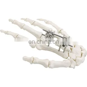 Guaranteed Quality Semi-circular External Fixator Orthopedic Surgical Implant thumbnail-3