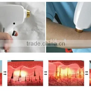 Germany Import Lamp 808nm Diode Laser Hair Removal/ Permanent Hair Removal Machine thumbnail-3