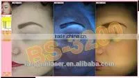 Beauty Machine Professional Portable Skin Analyzer With Distributor Price thumbnail-4