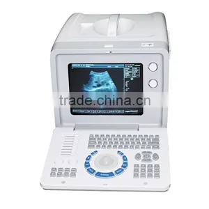 CE Certified Ultrasound Machine Portable Ultrasonic Diagnostic Scanner With 3.5MHz Convex Probe thumbnail-3