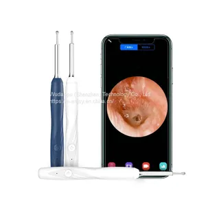 Visual Electric Ear Stick Cleaner Endoscopio Ear Pick Otoscope Borescope Ear Wax Cleaner thumbnail-4