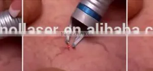 New Portable Vascular Removal Diode Laser Machine Price thumbnail-6