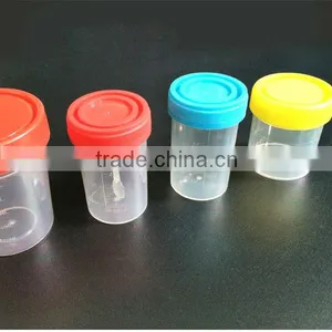 Stool Cup / Stool Container thumbnail-1