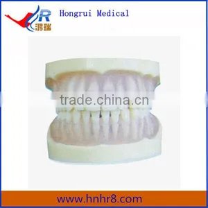 Hot Sale Full Mouth Standard Transparent PE Teeth Model thumbnail-1