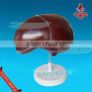 Liver Model thumbnail-5