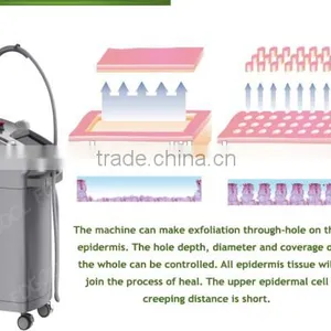 1540nm Erbium Glass Fractional Laser/ 1550nm Erbium Glass Fiber Laser Fogool Beijing thumbnail-6