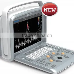 Laptop Color Doppler Ultrasound Price & Portable Color Doppler Ultrasound Machine thumbnail-4