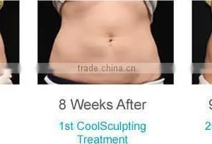 Best High Performance Frozen Cryo Lipo 3 Handle Cryo Sliming Machine thumbnail-3
