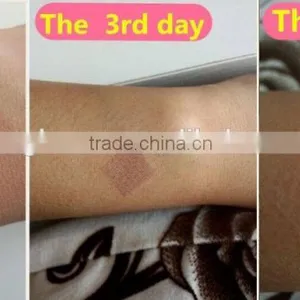 100um-2000um Fractional Laser Co2 / Co2 Fractional Laser RF Professional / Fractional Co2 Laser Scar Removal Machine Birth Mark Removal thumbnail-6