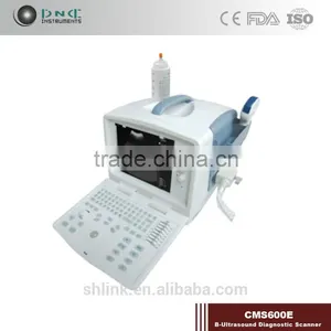 Top Grade Hotsale Link Digital Non-Interlaced Portable Ultrasound Scanner 200D With Low Price thumbnail-1