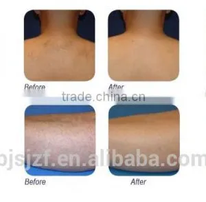 808T-2 Mini 808nm Diode Laser Diode Beauty Device for Hair Removal thumbnail-4