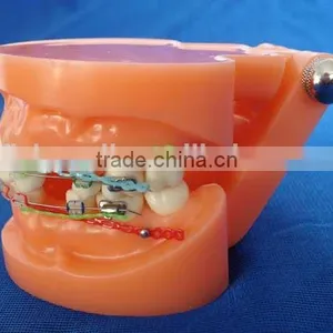 Dental Orthodontic Implant Study Plastic Dental Model of Teeth thumbnail-3