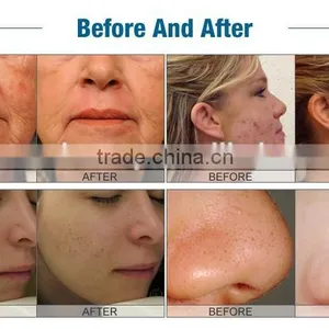 4in1 Facial Beauty Equipment for Hydro Skin Rejuvenation thumbnail-6