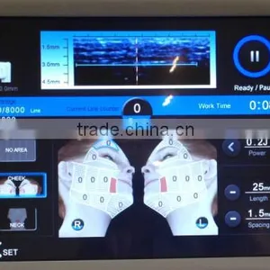 New System HIFU Equipment for Skin Lifting and Body Slimming thumbnail-4