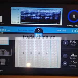 High Intensity Focused Ultrasound Face Lifting/Skin Tightening/Fat Removal thumbnail-3