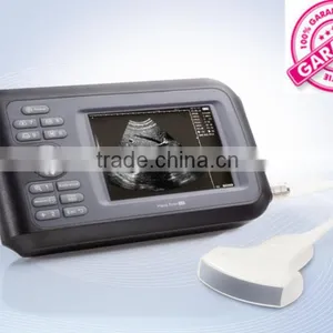 Mini 5.5 Inch Monitor Hand Held Ultrasound Scanner HandScan H8 With 3.5mhz Convex Probe thumbnail-1