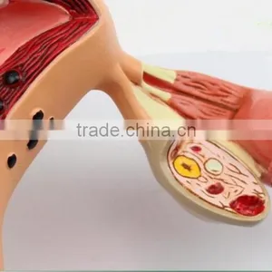 Human Uterus and Ovary Vaginal Pathological Changes Model of Reproductive Department of Gynecology Medical Demonstration Model thumbnail-4