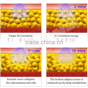 Fat Cavitation Machine Beauty & Personal Slimming Machine / 40K Ultrasonic Cavitation / Vacuum Radio Frequency 100J thumbnail-6