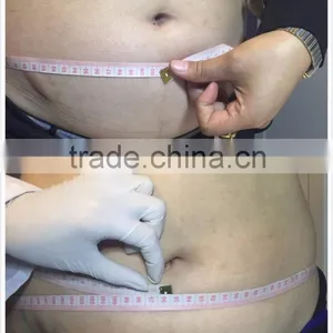 Liposonix Slim Beauty Equipment Cavitation Machine rf Vacuum thumbnail-5