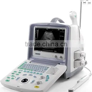 Portable USB Ultrasound Scanner Laptop Computer thumbnail-3