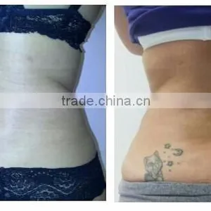 Spa Use Machine for Body Scupture Fat Removal Slimming Cryolipolise thumbnail-5
