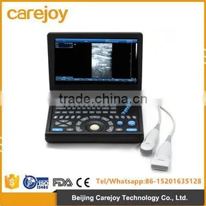 2016 New Laptop Ultrasound Scanner (PC System) With CE & ISO Certificate thumbnail-1