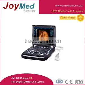 Portable 4D Ultrasound Scanner/4D Doppler Ultrasound Scanner System thumbnail-1