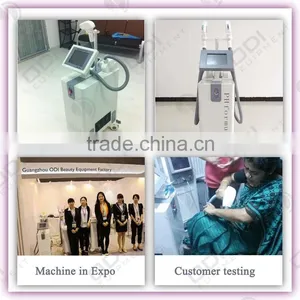 Positive Feedback 808nm Diode Laser Hair Removal Machine thumbnail-3