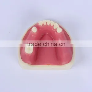 Trade Assurance Hot Dental Implant System CE Approved Dental Implant Model thumbnail-2