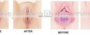 Model Number F7+ CO2 Laser Machine for Sale thumbnail-5