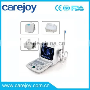 2016 Promotion!!CE Approved Portable Ultrasound Scanner With 3.5Mhz Multi-frequency Convex Probe RUS-9000A thumbnail-1