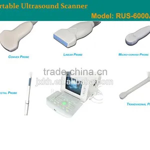 1 USB Factory Price OEM Design 80 Elements R60 Ultrasound Scanner for Pregnancy thumbnail-6
