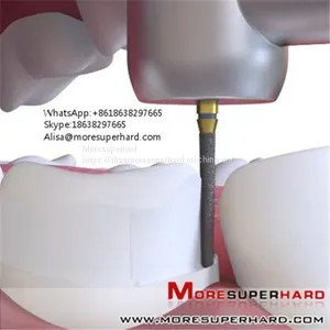 Dental Diamond Burs Alisa@moresuperhard.com thumbnail-2
