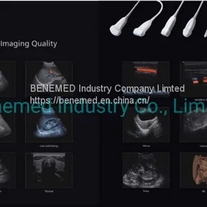 Premium 4D Color Doppler Ultrasound Scanner thumbnail-5