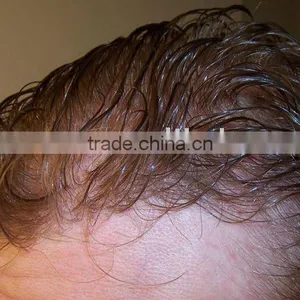 Mens Hair Piece thumbnail-1