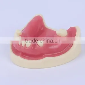 Trade Assurance Hot Dental Implant System CE Approved Dental Implant Model thumbnail-1