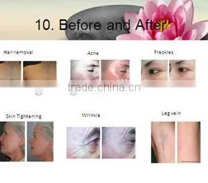2015 Best Selling Well Machine 2 Hand Piece Filter is Changable thumbnail-3