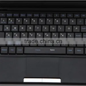 Carejoy Laptop Ultrasound Scanner / Machine With 3.5Mhz Convex Probe by CE ISO Approved thumbnail-5