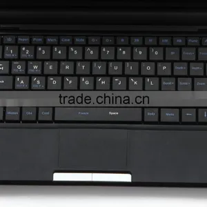 Clear Image Laptop Type Ultrasound Scanner System Full Digital Machine in Transport Carriage thumbnail-2